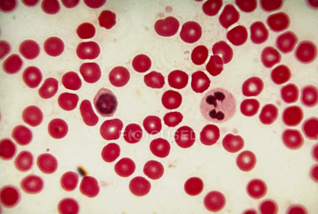 Micrografía ligera de glóbulos rojos humanos (eritrocitos), con dos glóbulos blancos no identificados (leucocitos) cerca del centro . - foto de stock