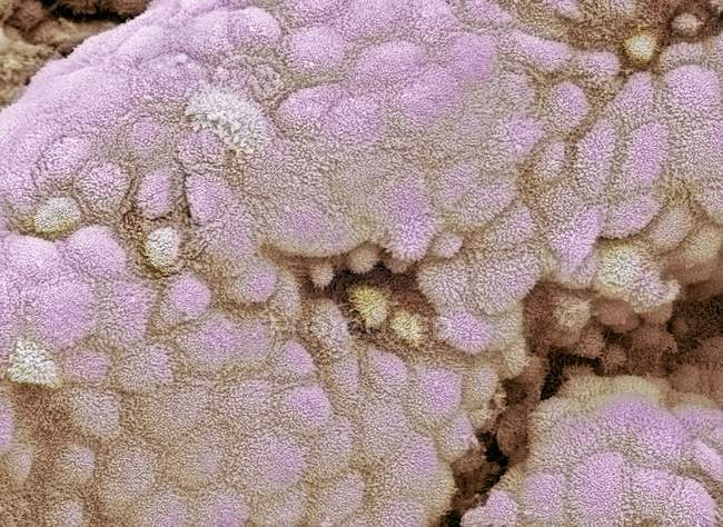 Microvilos da superfície da vesícula biliar — Fotografia de Stock