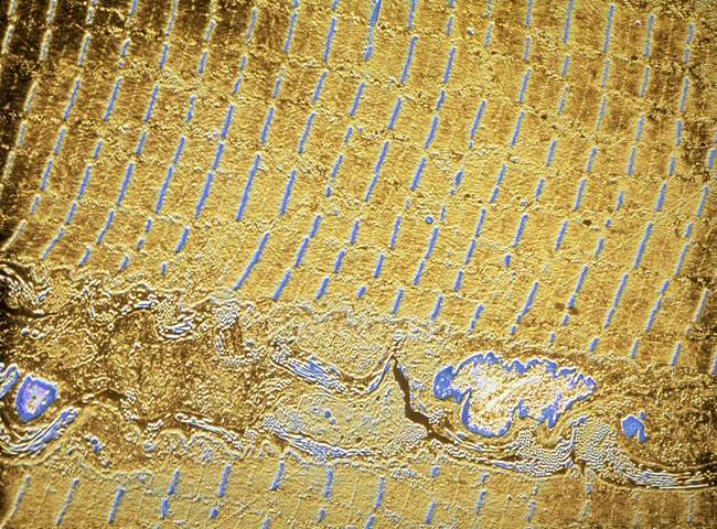 Micrografía electrónica de transmisión de color falso (TEM) del músculo estriado humano . - foto de stock