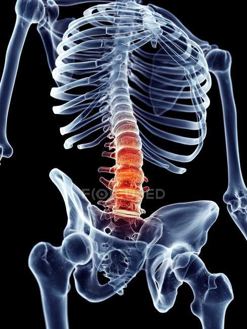 Dolor espinal humano - foto de stock