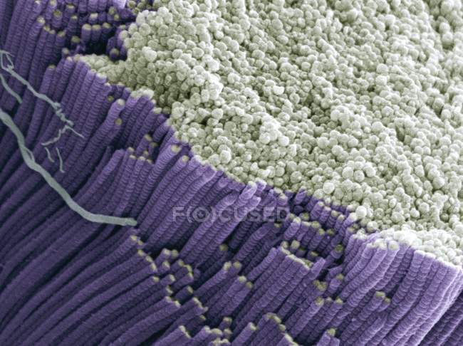 Tendão mostrando feixes de fibras colágenas — Fotografia de Stock