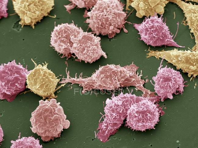 Cellules cancéreuses cultivées — Photo de stock
