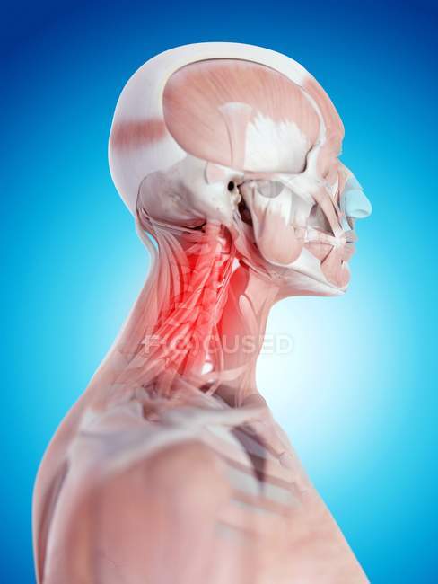 Localização da dor no pescoço — Fotografia de Stock