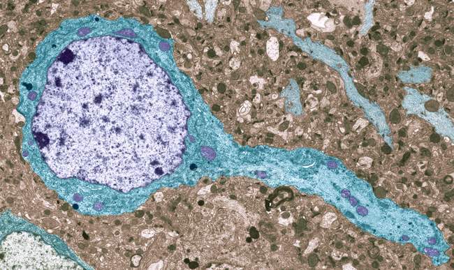 Neurone incorporé dans la matière grise — Photo de stock