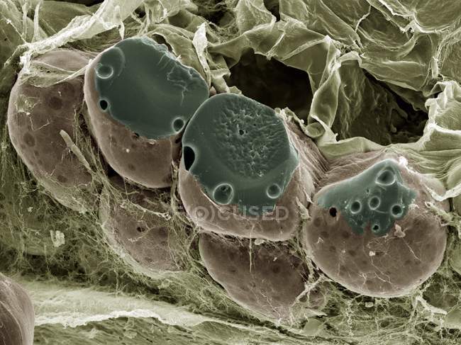 Tejido graso (adiposo), micrografía electrónica de barrido de color (SEM). Las células grasas (adipocitos, redondos) están rodeadas de fibras de colágeno. . - foto de stock