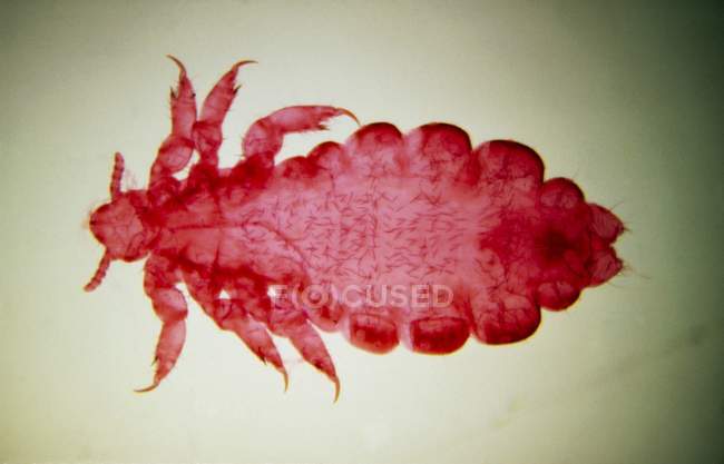 Female of the human body louse — Stock Photo