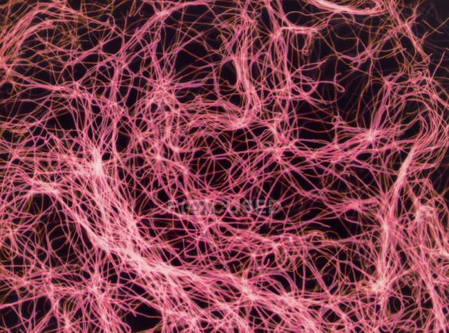 Паличковидні бактерії сибірської виразки — стокове фото