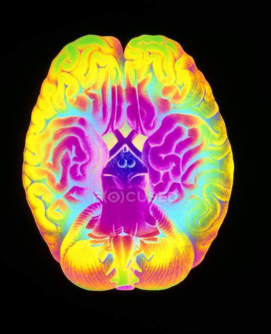Mascagni illustration du cerveau humain — Photo de stock