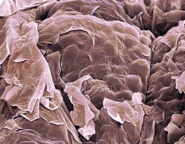 Цветной сканирующий электронный микрограф (СЭМ) плоских эпителиальных клеток на поверхности кожи
. — стоковое фото