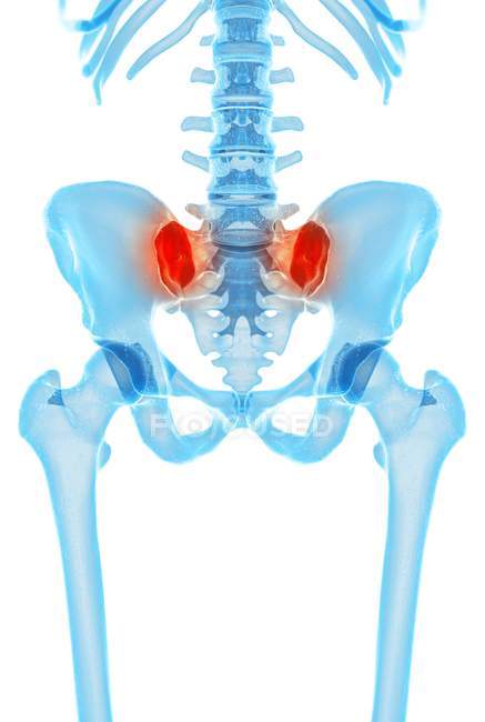 Localisation des douleurs de la hanche — Photo de stock