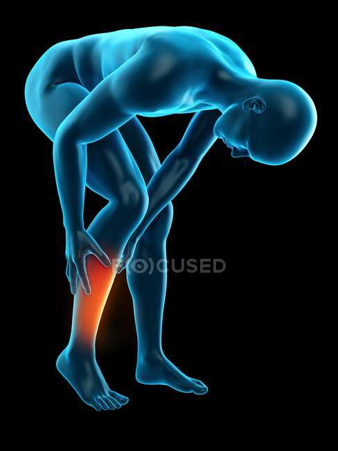 Dor localizada nos músculos da perna inferior — Fotografia de Stock