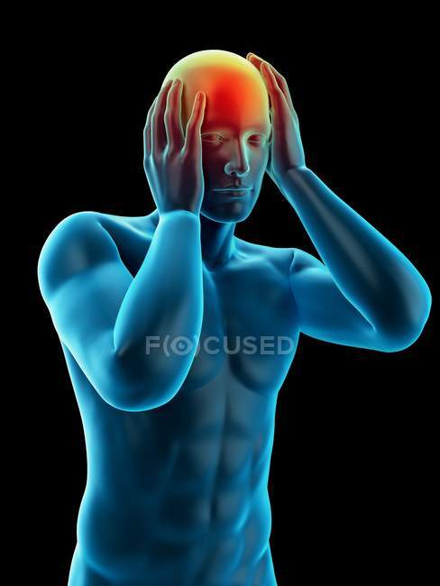 Визуальное представление сильной головной боли — стоковое фото