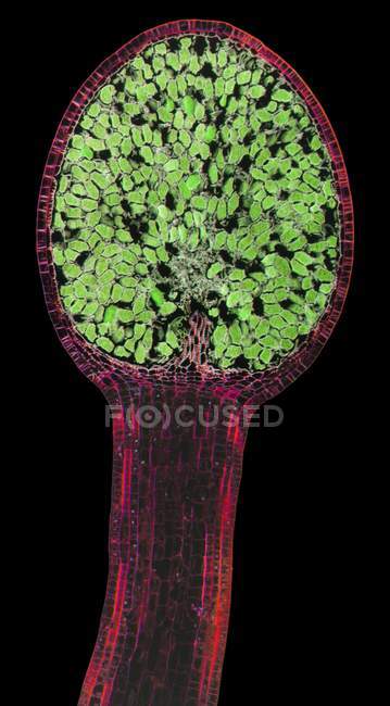 Легкий мікрограф (LM). Поздовжній переріз через такт і сперангіум печінки (Pellia epiphylla ). — стокове фото