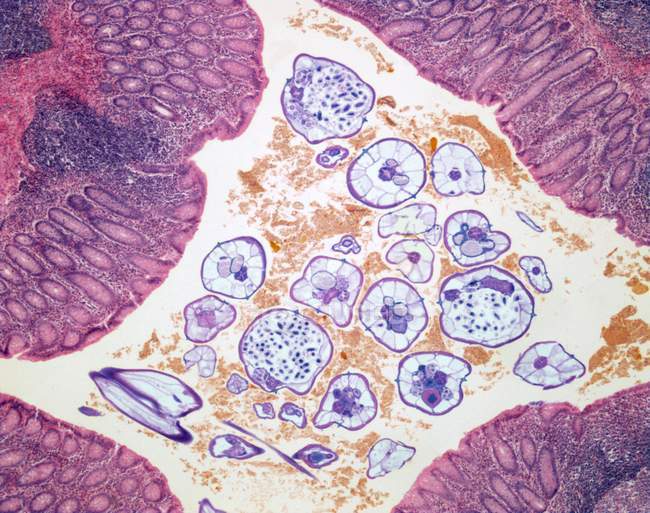Estomago infectado con gusanos nematodos parásitos - foto de stock