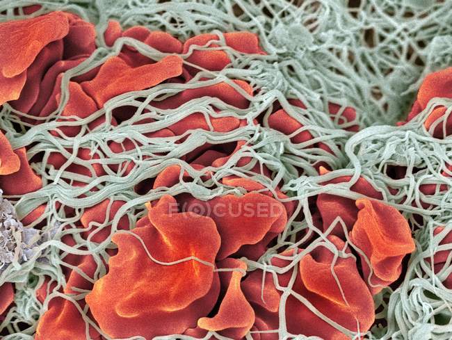 Estructura del coágulo sanguíneo - foto de stock