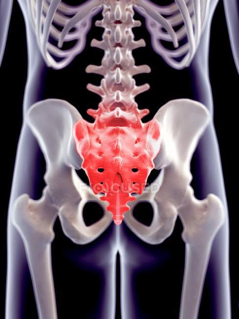 Focus of inflammation localized in sacrum — Stock Photo