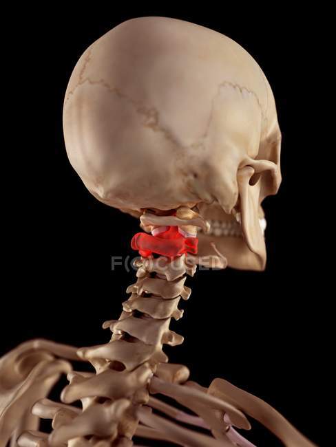 Dolor de cuello que afecta las vértebras cervicales - foto de stock