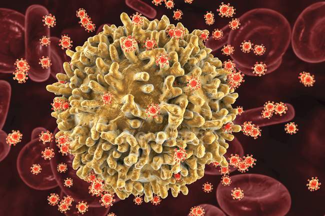 Hiv-Viren infizieren T-Lymphozyten-Zellen — Stockfoto