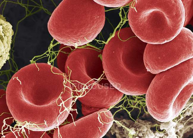 Formación de coágulos sanguíneos - foto de stock