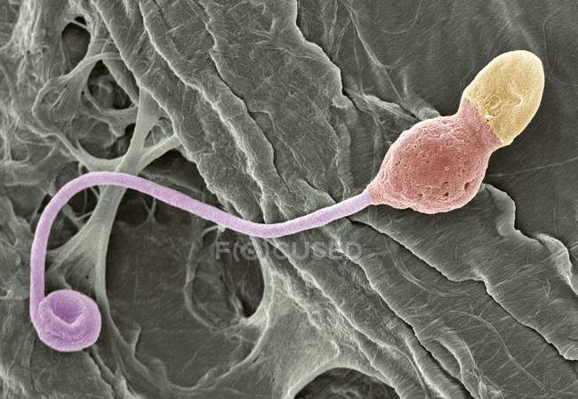 Деформированные сперматозоиды — стоковое фото