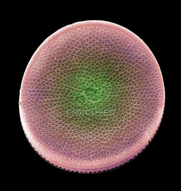 Actinocyclus sp. diatom unicellular algae — Stock Photo