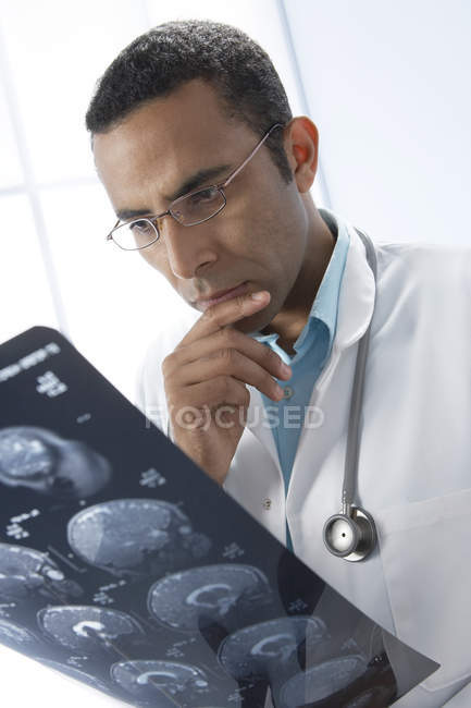 Médico masculino pensativo com a mão no queixo examinando a ressonância magnética . — Fotografia de Stock