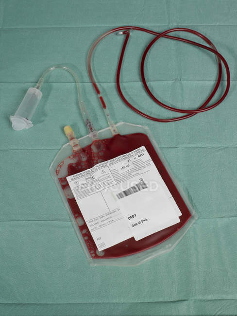 Bolsa que contiene sangre humana donada, placenta y cordón umbilical . - foto de stock