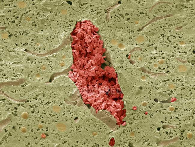 Coloured scanning electron micrograph (SEM) of a section through a vein in the liver, which is filled with red blood cells (erythrocytes, red). — Stock Photo