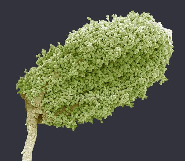Micrografia eletrônica de varredura colorida (MEV) de uma anêmona de madeira (Anemone nemerosa) antera (parte reprodutiva masculina) coberta de pólen
. — Fotografia de Stock