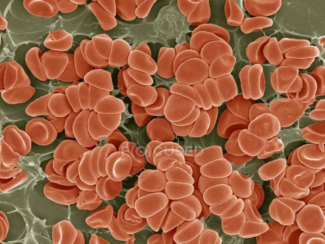 Red blood cells with fibrin — Stock Photo