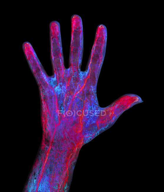 Artérias e veias da mão — Fotografia de Stock