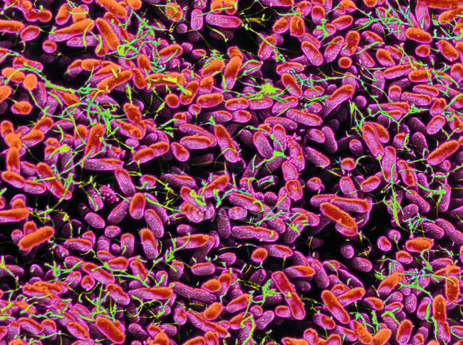 Bactérias Salmonella typhimurium — Fotografia de Stock