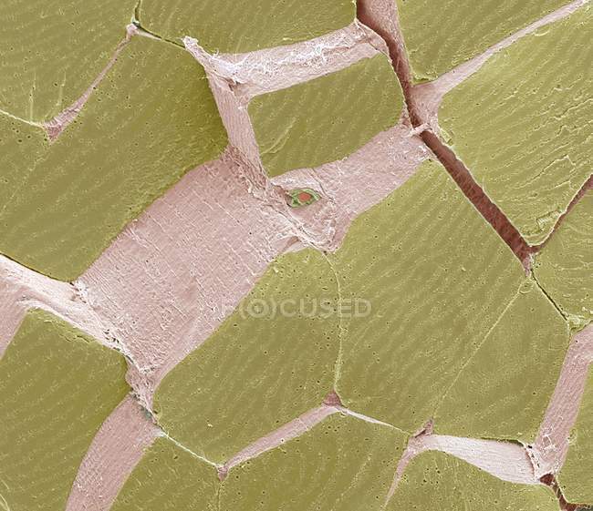 Цветной сканирующий электронный микрограф (СЭМ) секции через перелом скелетной мышцы, чтобы показать большие пучки мышц, или фасикл (зеленый), окруженный перимизиевой соединительной тканью (розовый ). — стоковое фото