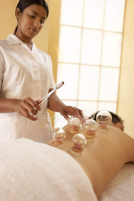 Therapist heating cups on client back while cupping therapy. — Stock Photo