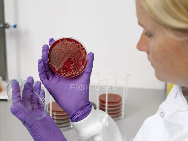 Tests zur bakteriellen Kontamination — Stockfoto