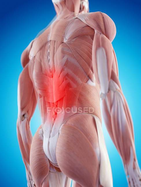 Pain localized in thoracic section of spine — Stock Photo