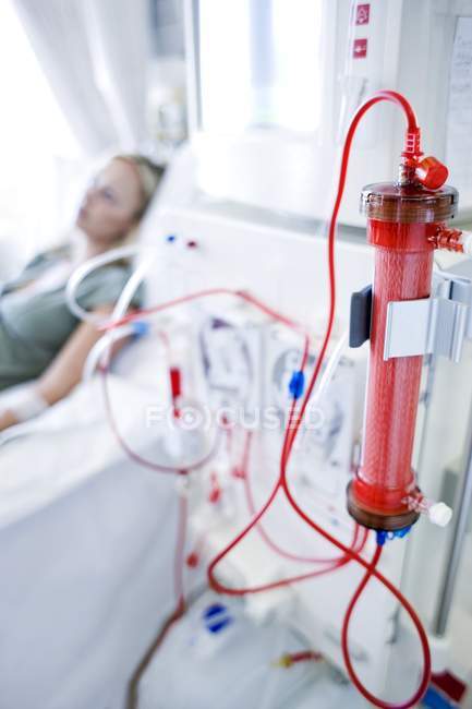Close-up of external filter for treatment of patient with kidney failure. — Stock Photo