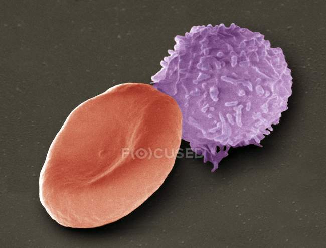 Цветной сканирующий электронный микрограф (СЭМ) красных кровяных телец человека (эритроцит, красный) и белых кровяных телец (лейкоцит, синий ). — стоковое фото