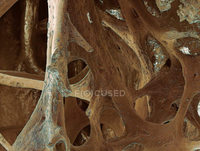 Coloured scanning electron micrograph (SEM) of the interior of bone from a bird skull. — Stock Photo