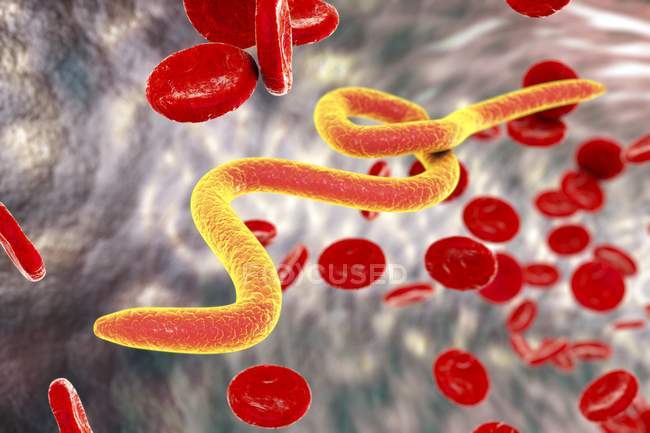 Mikrofilaria-Würmer im Blut — Stockfoto