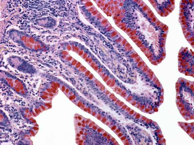 Revestimento do cólon e células produtoras de mucosas — Fotografia de Stock