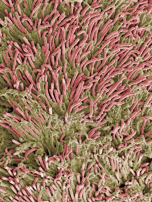 Бактерии, образующие зубную табличку — стоковое фото