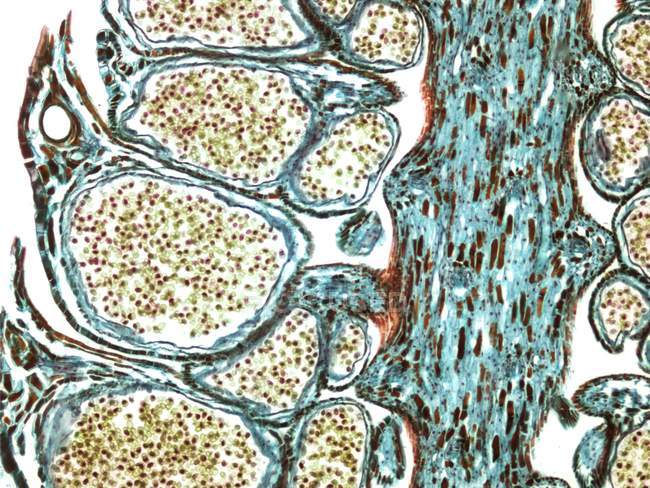 Световой микрограф продольного сечения через мужской сосновый конус, показывающий пыльцу (желтый ). — стоковое фото