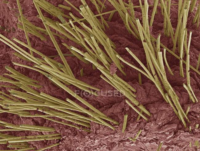 Hair shafts growing from human skin — Stock Photo