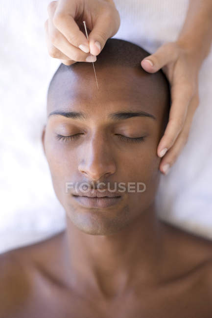 Acupuncturist inserting needle into male client forehead. — Stock Photo