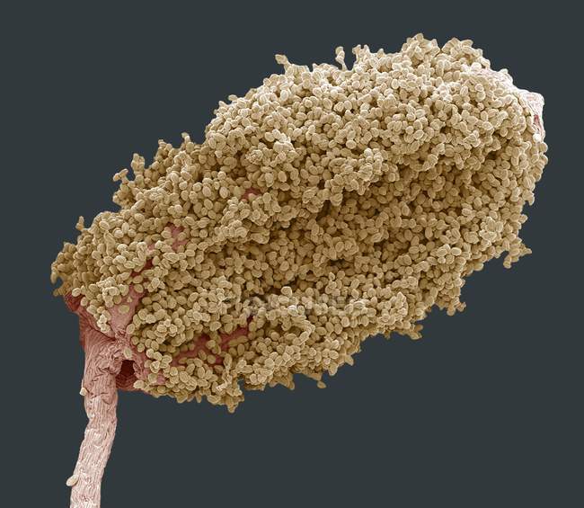 Micrografo elettronico a scansione colorata (SEM) di un anemone di legno (Anemone nemerosa) antera (parte riproduttiva maschile) ricoperta di polline
. — Foto stock