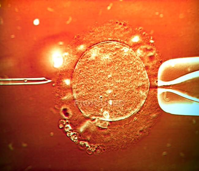 Fertilización de óvulos humanos - foto de stock