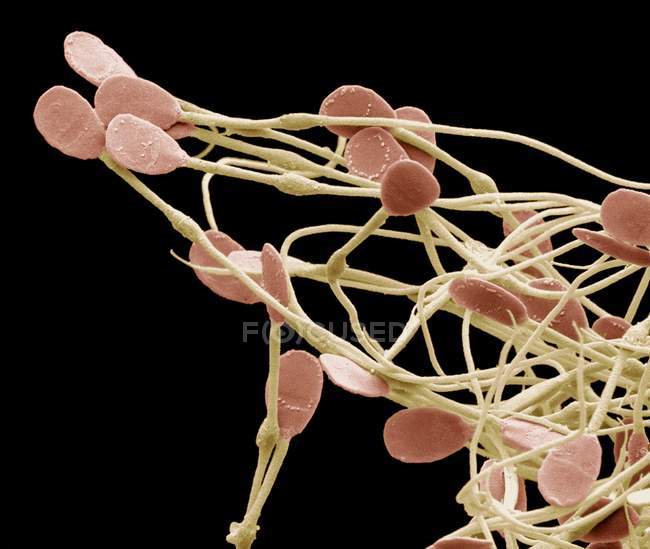 Coloured scanning electron micrograph (SEM) of immature dog sperm. — Stock Photo