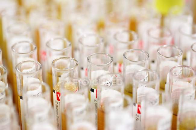 Tubos de ensayo etiquetados con muestras de sangre
. - foto de stock
