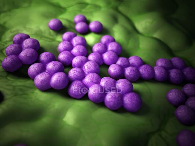 Methicillin-resistenter Staphylococcus aureus — Stockfoto